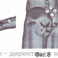 Неогард лайф - магнитен уред за защита и терапия – снимка 5