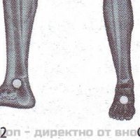Неогард лайф - магнитен уред за защита и терапия – снимка 3