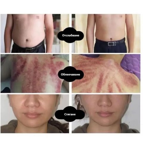 Професионален апарат за кавитация, RF, вакуум и електростимулация – снимка 2