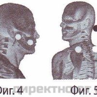 Неогард лайф - магнитен уред за защита и терапия – снимка 6