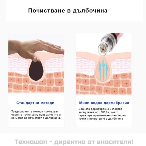 Мини водно дермабразио Lescolton-1 – снимка 8