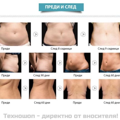 Апарат за кавитация, вакуум и радиочестотен лифтинг 5в1 – снимка 2